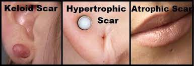 Pin On New Piercing Ideas 2017 After Nose