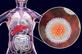 Image result for hepatitis symptoms