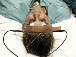 Scientists Reveal How Electro-Shock Therapy May Treat Depression after More  than 70yrs