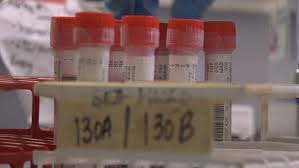 N B Public Health Reports Five New Cases Of Covid 19 Ctv News