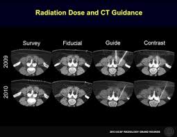 Christopher Hess Md Phd Ucsf Radiology