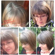 Gray Hair Grow Out Progress Month 3 5 6 7 And The 8th Month Mark Late June 2015 Ellendugan Gray Hair Growing Out Beautiful Gray Hair Silver Grey Hair