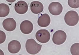 Finden sie hier alle notwendigen informationen auf malaria.info. Mikroskopische Abbildung Der Malaria Tertiana
