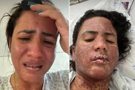 Frank Aguiar e a mulher reatam por causa de doença rara. Entenda!