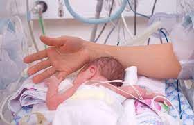 Parto Prematuro Cuando El Bebe Nace Antes De Tiempo