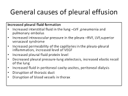 To a great extent, the outlook for patients with pleural effusion depends on the primary cause of effusion and whether it can be eliminated. Pleural Effusion