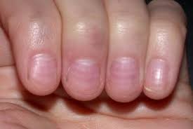 Check spelling or type a new query. The Hand Examination Stanford Medicine 25 Stanford Medicine