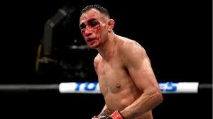 This page is about tony ferguson elbow,contains tony ferguson wallpapers hd,tony tony ferguson undergoes elbow surgery, recovery time unknown. Ufc 249 Gaethje Punishes Ferguson For Almost Five Whole Rounds