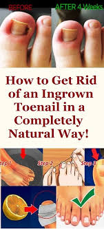 Pin On Stay Naturally Healthy