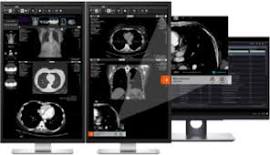 Radiology AI Imaging | Aidoc