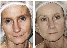 Professional Skincare