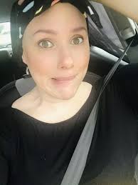 Model covered hair loss for 16 years from age 13 with wigs