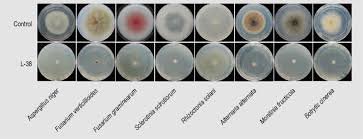 Image result for Staphylococcus Saprophyticus