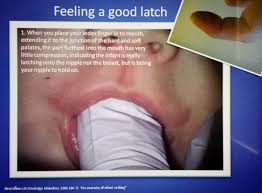 If you can see an obvious string attaching near the top of the tongue, then there is very likely a restriction present that could be affecting your child. Step By Step Guide To Checking For Tongue Lip Ties