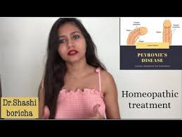 Peyronie S Disease Homeopathic Treatment For Peyronie S Disease Youtube