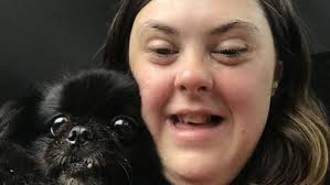 My story: Mum's battle to get right support for her daughter with Down's  syndrome