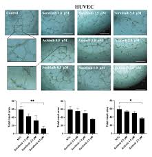Ex Vivo Evaluation of Antiangiogenic Drugs in Oral Cancer: Potential  Implications for Targeting Vasculogenic Mimicry | Anticancer Research