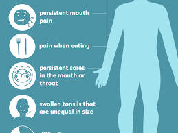 Early warning signs of cancer of the throat. Tonsil Cancer Overview And More