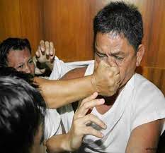 La femme a bien reçu un coup violent au visage, et le médecin rapporte que des marques de strangulation apparaissent au niveau de son cou. Poing Ecrase