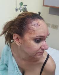 Four Individuals to Appear in Court for Savage Beating of Guyanese  Businesswoman