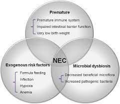 This is a basic glossary for medical transcriptionists who use instant text. Recessed Lighting Installation Necrotizing Enterocolitis Pathophysiology Necrotizing Enterocolitis Review Of State Of The Art Imaging Findings With Pathologic Correlation Radiographics Necrotizing Enterocolitis Nec Is Not A New Disease