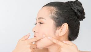 Makanan yang mengandung banyak cabai menjadi salah satu penyebab terbesar jerawat. Kulit Rentan Dengan Jerawat Hindari Kopi Keju Dan 6 Makanan Ini Gaya Tempo Co