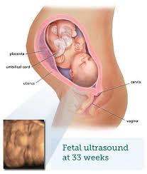 At 33 weeks pregnant, your baby is about 11 3/4 inches (crl), 17 inches in height, and weighs 4 1/2 pounds. Fetal Ultrasound 7 Months Babycentre Uk