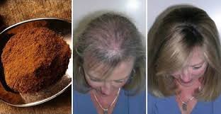 Essa restituisce la lucentezza, riduce l'effetto crespo, cura le punte sfibrate e . La Spezia Che Blocca La Caduta Dei Capelli E Ne Stimola La Ricrescita In Pochi Giorni Rimedio Naturale