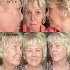 We are thrilled to announce a dynamic 𝐊𝐢𝐧𝐞𝐒𝐲𝐬 collaboration between  our esteemed 𝗗𝗼𝗰𝘁𝗼𝗿 𝗠𝗮𝗻𝘂𝗲𝗹 𝗖𝗲𝗷𝗮 and the talented  𝗘𝘀𝘁𝗵𝗲𝘁𝗶𝗰𝗶𝗮𝗻 𝗠𝗶𝗿𝘁𝗮 𝗦𝗮𝗻𝗱𝗼𝗺𝗶𝗿! 💫✨