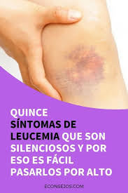 A medida que las células leucémicas se acumulan en la médula, pueden sobrepasar en número a las células sanguíneas normales. Pin En Leucemia