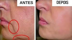 Calcio E Oil Antes E Depois Reviva Os Cabelos Danificados Em 15 Minutos Com Apenas Um Ingrediente Dicas Naturais Em 2020 Rugas Como Clarear O Cabelo Alisamento Caseiro Para Cabelos