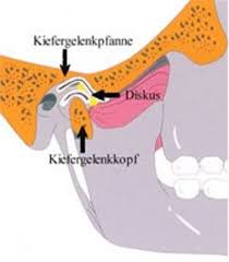 Kopf Nacken Ruckenschmerzen U Tinnitus Therapie Zahnarztpraxis Geragori