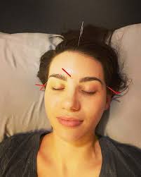 Acupuncture Plus-Jacksonville, 8280 Princeton Square Blvd W, Ste 1,  Jacksonville, FL 32256, US