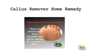 Like apple cider vinegar, hydrogen peroxide is an effective antifungal.7 x trustworthy source pubmed central journal archive from the u.s. How To Get Rid Of Calluses On Feet 11 Callus Remover Home Remedies