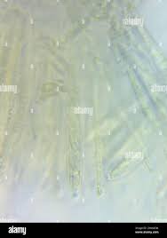 Image result for Chlorosplenium chlora