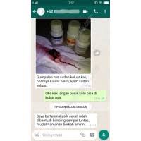 Cara menggugurkan kandungan dengan makanan dan minuman cara menggugurkan kandungan secara herbal cara paling aman dan efektif untuk menggugurkan kandungan di bawah 12 minggu adalah. Cara Menggugurkan Janin Yang Aman Bagi Ibunya Dan Cepat 081218935554 Linkedin