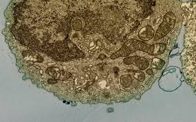 Image result for B-Lymphocyte