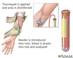 Image result for Venous Blood Sampling