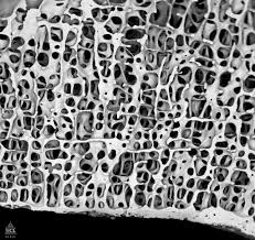 Important features in the bone cross section such as harvesian canals, osteons, osteon fragments, lamellar bone, bony trabeculae, myxoid matrix and artifact for. Microscopy Bonearchimorph