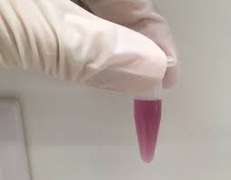 Myokarditis (herzmuskelentzündung) ist eine sammelbezeichnung für entzündliche erkrankungen des herzmuskels mit unterschiedlichen ursachen. Etwas Text Zu Diesem Und Jenem