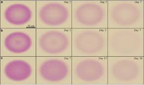 Erythema migrans or erythema chronicum migrans is an expanding rash often seen in the early stage of lyme disease, and can also (but less. Appearance Of Lyme Disease Rash Can Help Predict How Bacteria Spreads Through Body