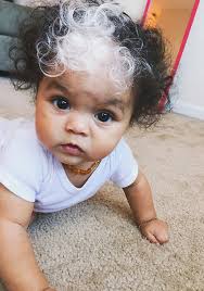 See the progression, causes, and treatments for this distressing condition i this webmd slideshow. Little Girl Born With A White Patch Of Hair Which Is Exactly The Same As Her Mum S Bored Panda