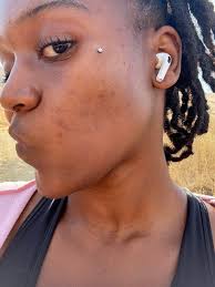 Routine Help] any recommendations