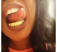 Pin By Richnnaa On Mouth Full Of G R I L L Z Grillz Teeth Girl Grillz Grillz