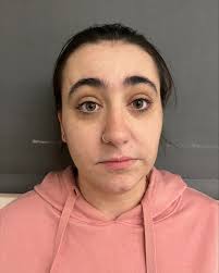 Three arrested in connection to St. Johsnbury stabbing that hospitalized  one man