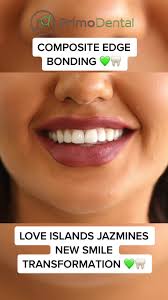 Jasmine Eats Teeth Transformation