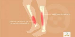 Tulang pangkal lengan (humerus), hasta (ulna), pengumpil (radius) tulang pangkal lengan (humerus) tulang adalah bentuk khusus jaringan ikat dengan kerangka kolagen yang mengandung garam contoh : Artikel Bidai Tulang Kering