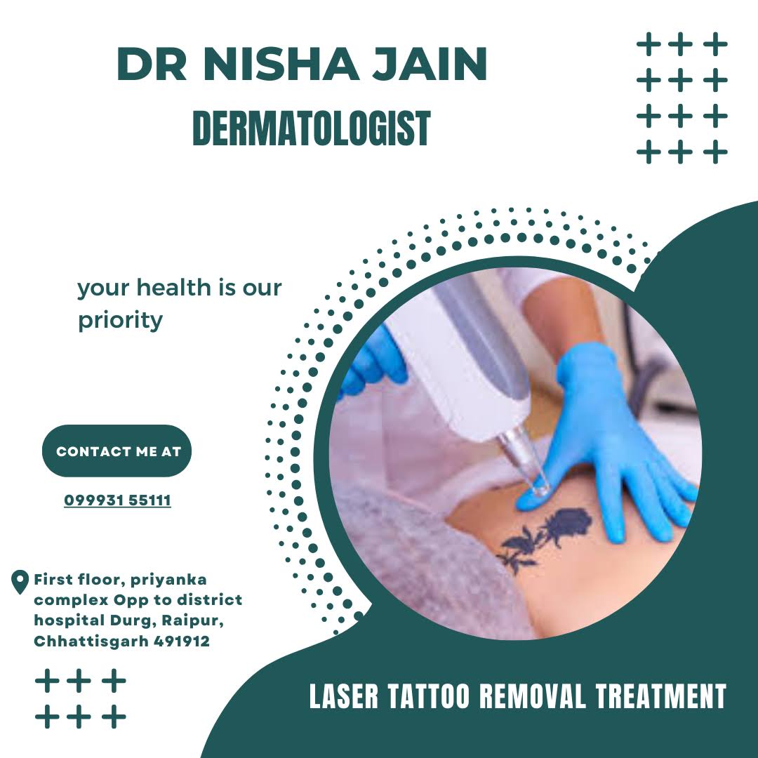 Laser Tattoo Removal Treatment product image