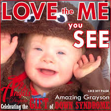 Character has congenital heart defect