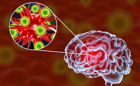 La encefalitis equina venezolana es producida por el virus del mismo nombre, (eevv, miembro de la familia togaviridae, género alphavirus ) el cual fue aislado en 1938. Ee Uu Alerta Un Nuevo Caso De Encefalitis Equina Del Este En Michigan Un Virus Con Infeccion Mortal